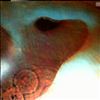 Pink Floyd -- Meddle (1)